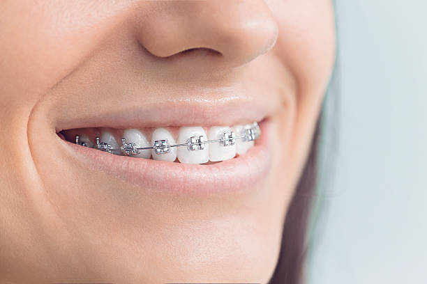 Best Full Mouth Reconstruction  in Sleepy Hollow, CA
